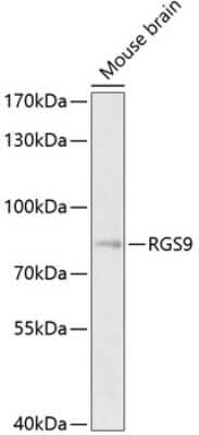 Western Blot: RGS9 AntibodyBSA Free [NBP2-93231]