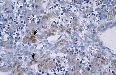 Immunohistochemistry-Paraffin: RGS9 Antibody [NBP1-58919]