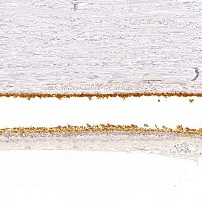 Immunohistochemistry-Paraffin: RGS9 Antibody [NBP2-58294]