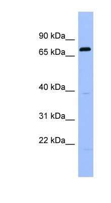 Western Blot: RGS9 Antibody [NBP1-58909]