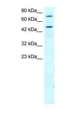 Western Blot: RGS9 Antibody [NBP1-58919]