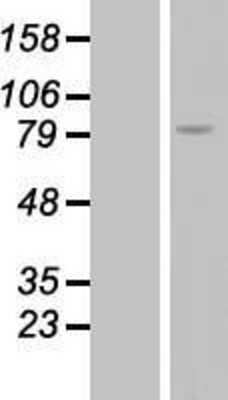 Western Blot: RGS9 Overexpression Lysate [NBL1-15339]