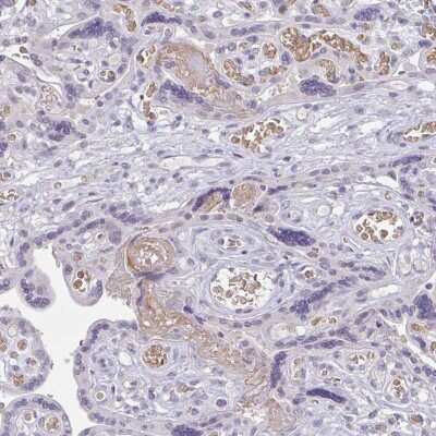 Immunohistochemistry: RHAG Antibody [NBP2-49180]