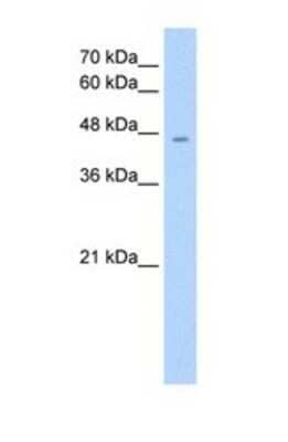 Western Blot: RHAG Antibody [NBP1-69665]