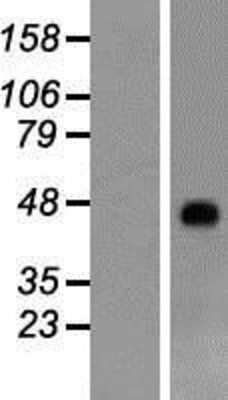 Western Blot: RHAG Overexpression Lysate [NBP2-09037]