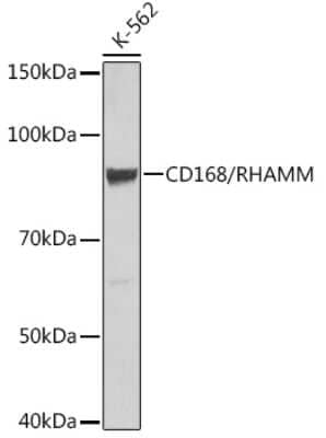 Western Blot: RHAMM/CD168 Antibody (3L10H9) [NBP3-15424]