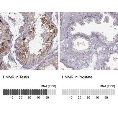 Immunohistochemistry-Paraffin: RHAMM/CD168 Antibody [NBP2-38459]