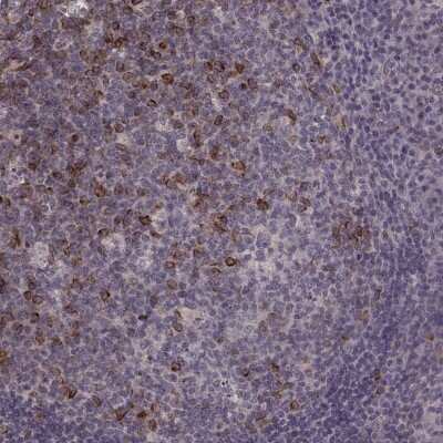 Immunohistochemistry-Paraffin: RHAMM/CD168 Antibody [NBP2-38459]
