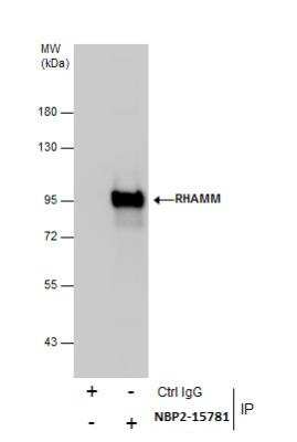 Immunoprecipitation: RHAMM/CD168 Antibody [NBP2-15781]