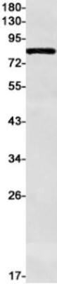 Western Blot: RHAMM/CD168 Antibody (S02-3E1) [NBP3-19597]