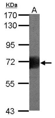 Western Blot: RHAMM/CD168 Antibody [NBP1-31797]