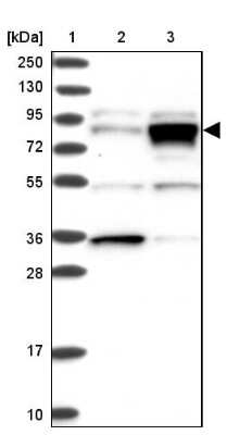 Western Blot: RHAMM/CD168 Antibody [NBP2-38459]