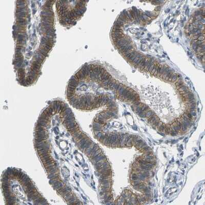 Immunohistochemistry-Paraffin: RHBDD1 Antibody [NBP1-85092]