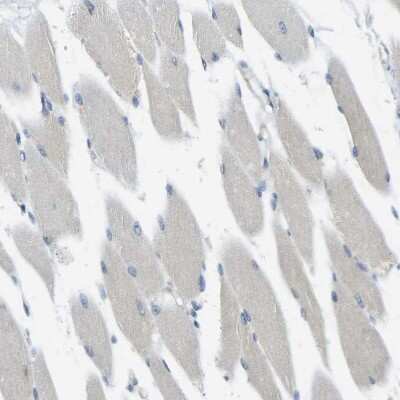 Immunohistochemistry-Paraffin: RHBDD1 Antibody [NBP1-85092]