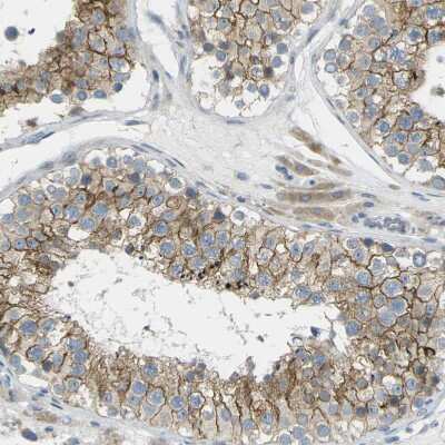 Immunohistochemistry-Paraffin: RHBDD1 Antibody [NBP1-85092]