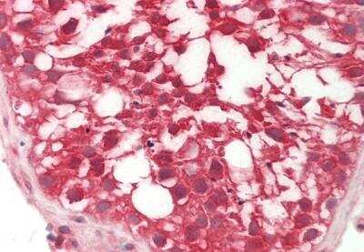 Immunohistochemistry-Paraffin: RHBDD1 Antibody [NBP2-88151]