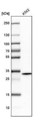 Western Blot: RHBDD1 Antibody [NBP1-85092]