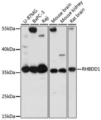 Western Blot: RHBDD1 AntibodyAzide and BSA Free [NBP2-93306]