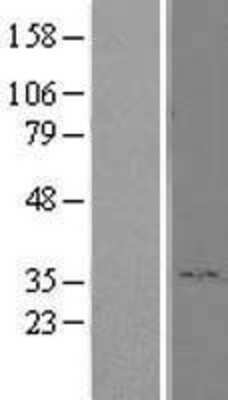 Western Blot: RHBDD1 Overexpression Lysate [NBL1-15340]