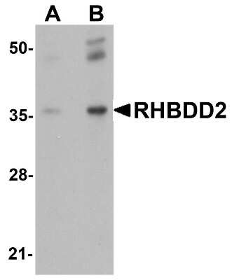 Western Blot: RHBDD2 AntibodyBSA Free [NBP1-76249]