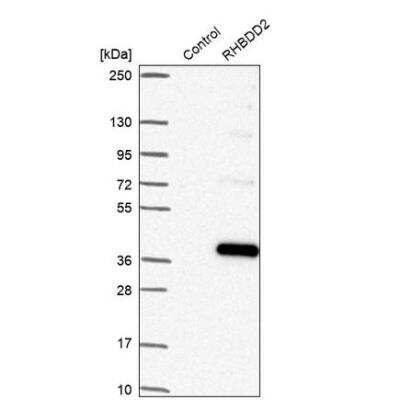 Western Blot: RHBDD2 Antibody [NBP1-92330]