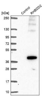 Western Blot: RHBDD2 Antibody [NBP2-47305]