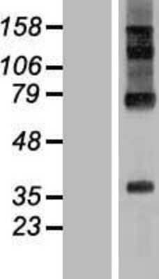 Western Blot: RHBDD2 Overexpression Lysate [NBL1-15341]