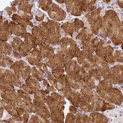 Immunohistochemistry-Paraffin: RHBDD3 Antibody [NBP1-92331]