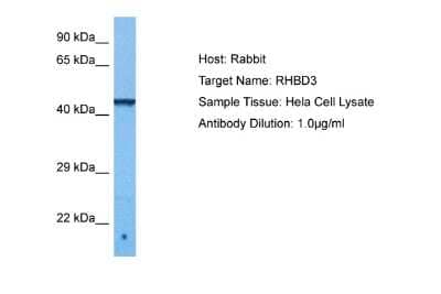 Western Blot: RHBDD3 Antibody [NBP2-85634]