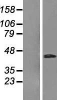 Western Blot: RHBDD3 Overexpression Lysate [NBL1-15342]