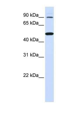 Western Blot: RHBDF1 Antibody [NBP1-59725]