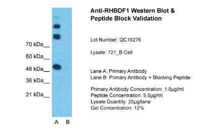 Western Blot: RHBDF1 Antibody [NBP1-59725]