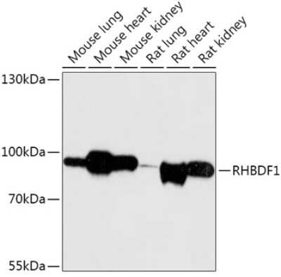 Western Blot: RHBDF1 AntibodyAzide and BSA Free [NBP2-94068]