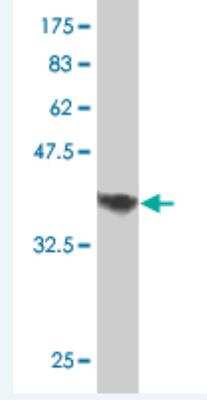 Western Blot: RHBDL1 Antibody (5B11) [H00009028-M05]