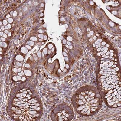 Immunohistochemistry-Paraffin: RHBDL1 Antibody [NBP2-13229]