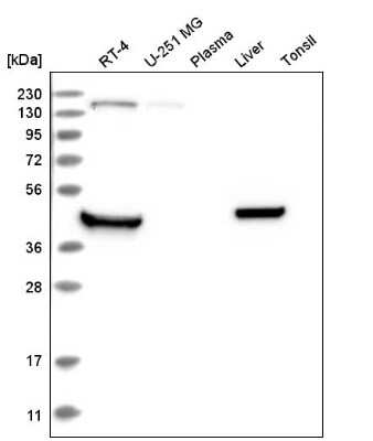 Western Blot: RHBDL1 Antibody [NBP2-57512]