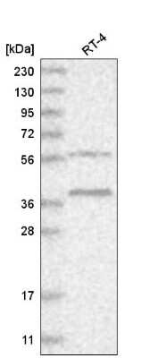 Western Blot: RHBDL1 Antibody [NBP2-57513]