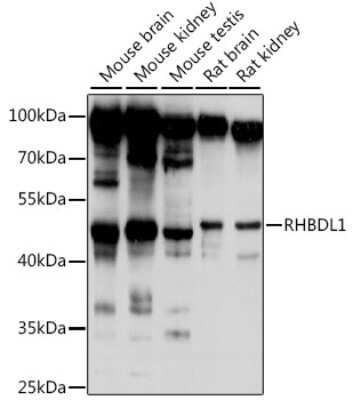 Western Blot: RHBDL1 AntibodyAzide and BSA Free [NBP2-93706]