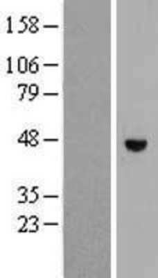 Western Blot: RHBDL1 Overexpression Lysate [NBP2-07931]