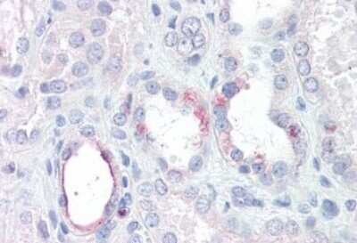 Immunohistochemistry-Paraffin: RHBG Antibody [NBP1-52180]