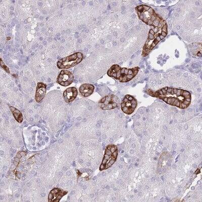 Immunohistochemistry-Paraffin: RHBG Antibody [NBP2-33527]