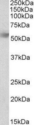 Western Blot: RHBG Antibody [NBP1-52075]