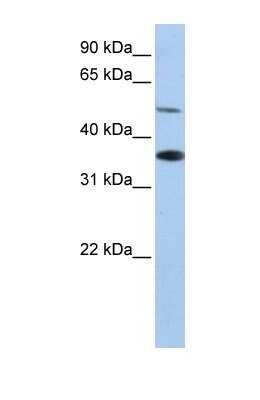 Western Blot: RHBG Antibody [NBP1-69483]