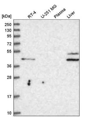 Western Blot: RHBG Antibody [NBP2-59022]