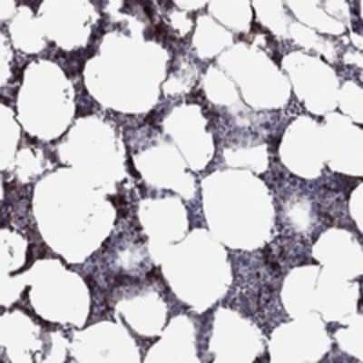 Immunohistochemistry-Paraffin: RHCE Antibody [NBP3-17923]