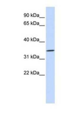 Western Blot: RHCE Antibody [NBP1-69668]