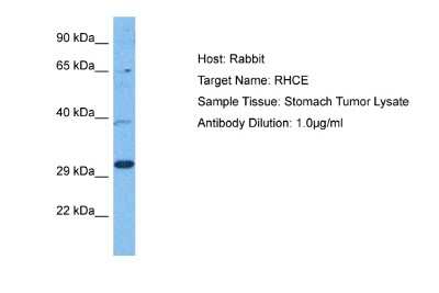 Western Blot: RHCE Antibody [NBP2-86778]