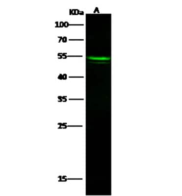 Western Blot: RHCE Antibody [NBP2-98927]