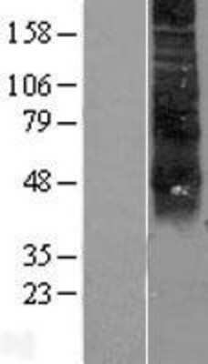 Western Blot: RHCE Overexpression Lysate [NBL1-15345]