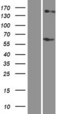 Western Blot: RHCE Overexpression Lysate [NBP2-09970]